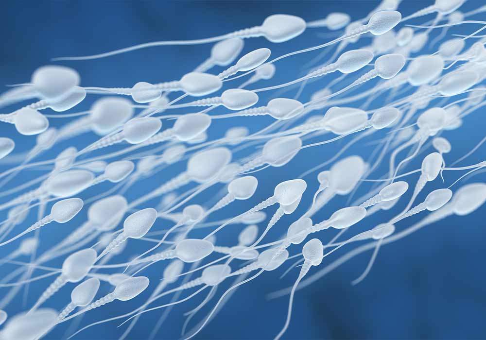 spermiogramma-napoli