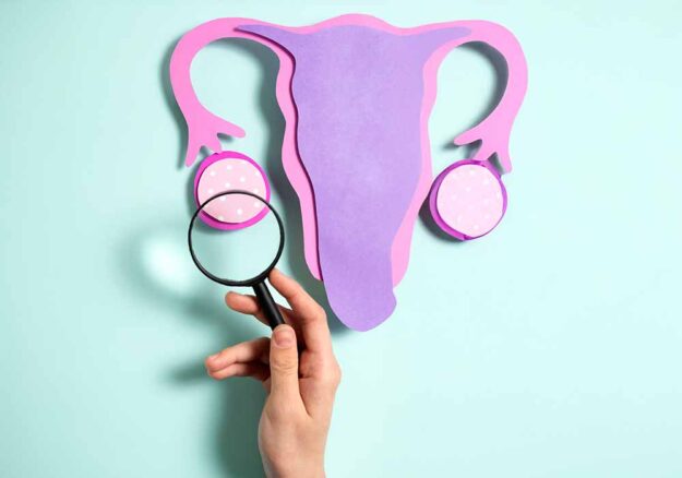 ovaio-micropolicisitico